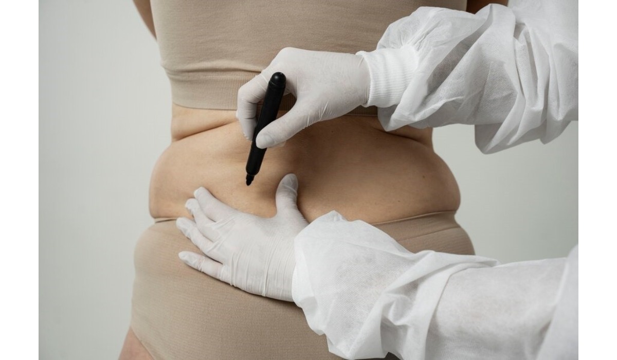 EmTone cellulite treatment device applied to a patient's leg