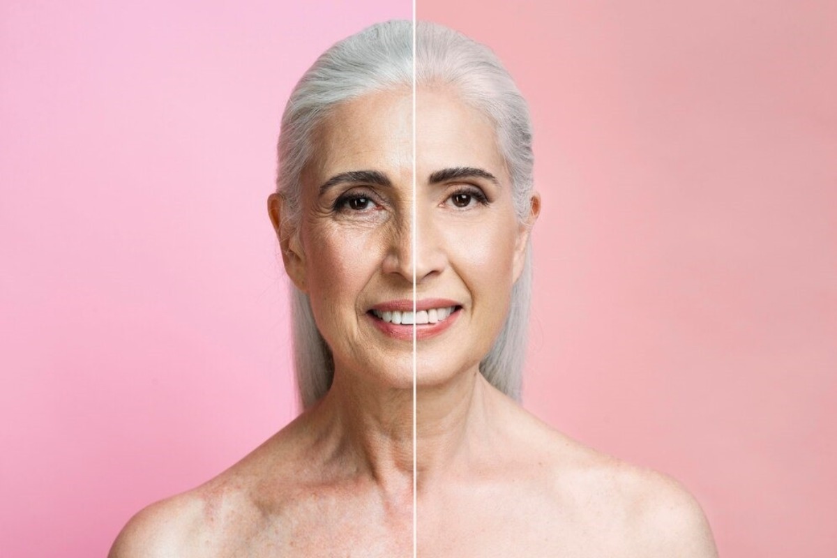 Patient consulting with a provider about cellulite treatment options