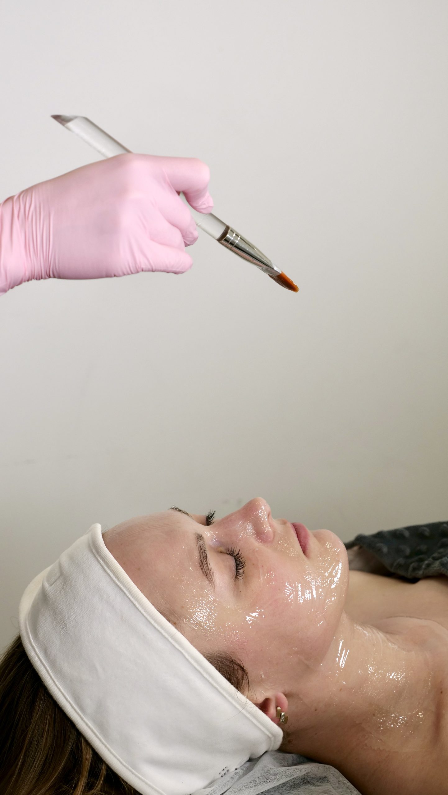 Licensed skin care professional applying a chemical peel treatment to a patient’s face at Just Lose Weight MD Clinic.