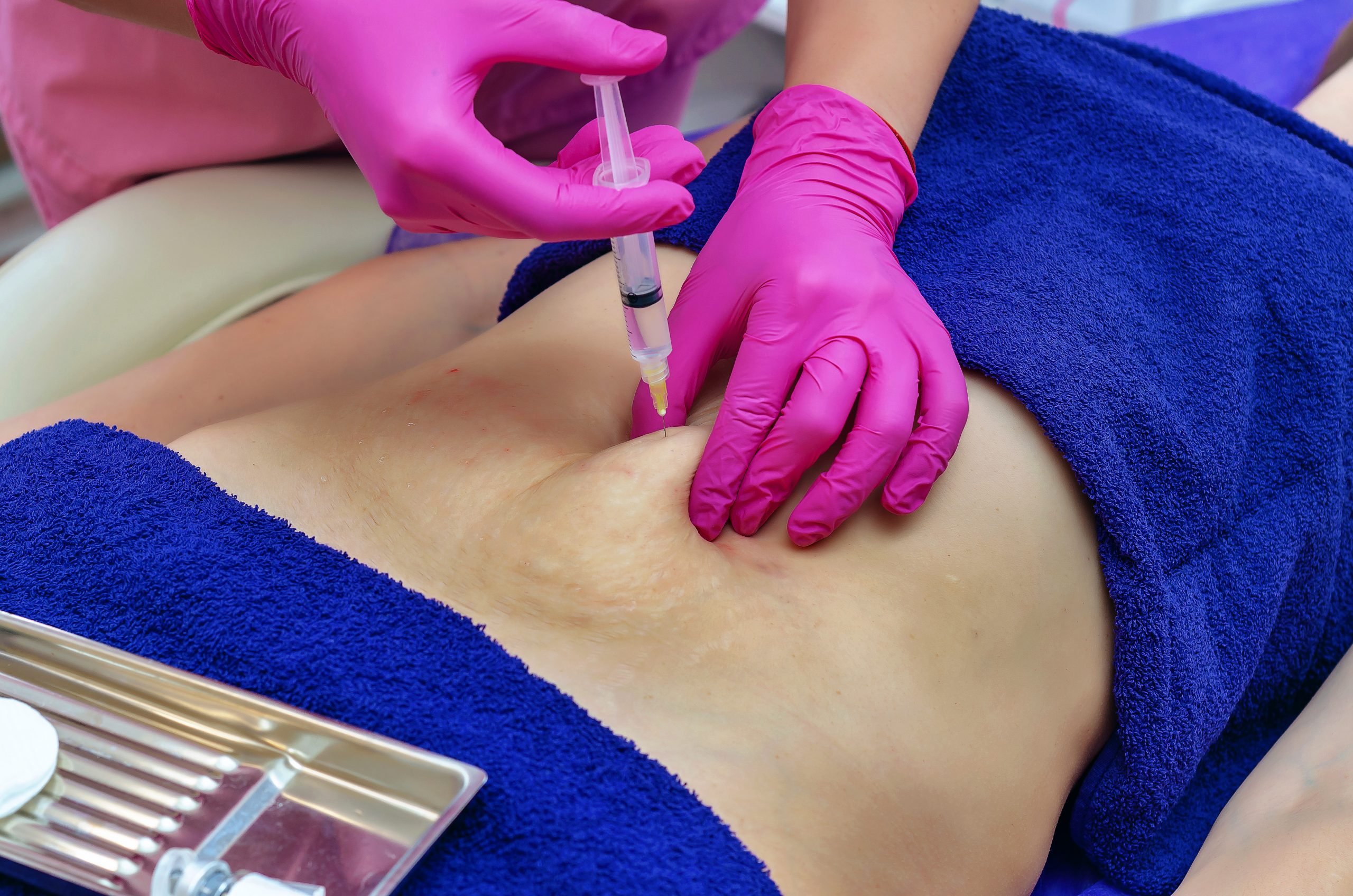 Non-surgical fat dissolving injections near me at Just Lose Weight MD Clinic